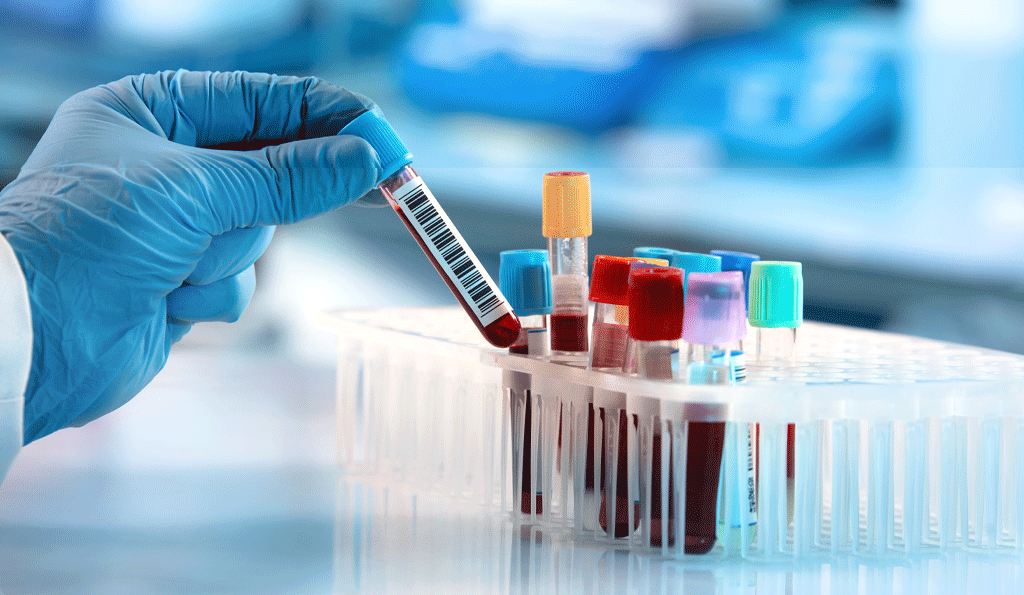 Scientists holding blood sample tubes